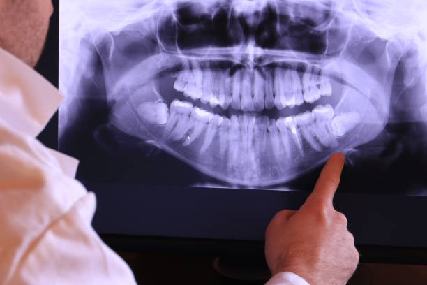Best Emergency Dental Care for Broken or Chipped Teeth in Fivepointville, PA