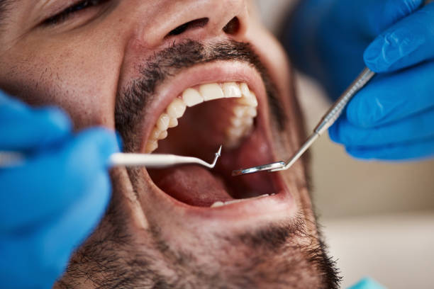 Best Emergency Treatment for Dental Infections or Abscesses in Fivepointville, PA